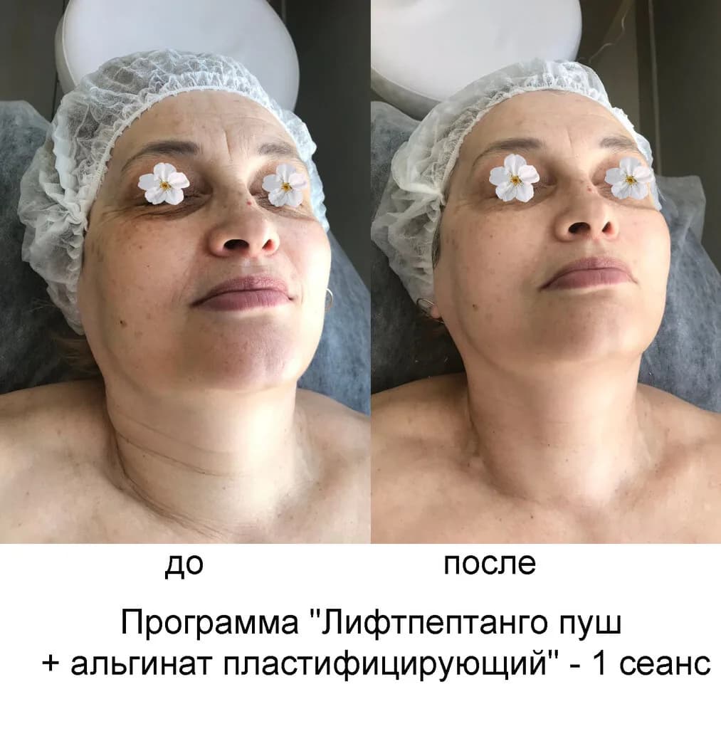 Эстетическое пространство «Bliss (Блисс)» — фото 6