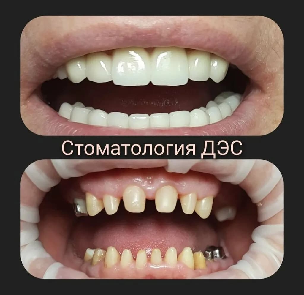 «Стоматология ДЭС» — фото 4