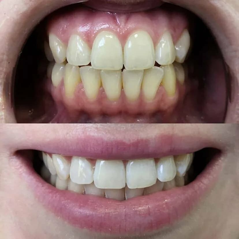 Студия косметического отбеливания зубов «My Brilliant Smile (Май Бриллиант Смайл)» — фото 3