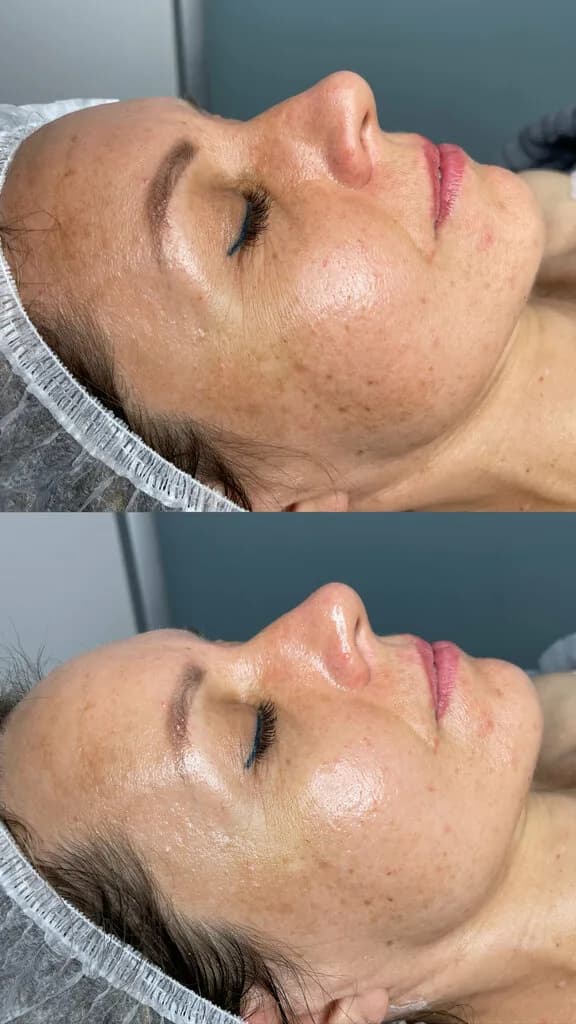 Bilan_massage