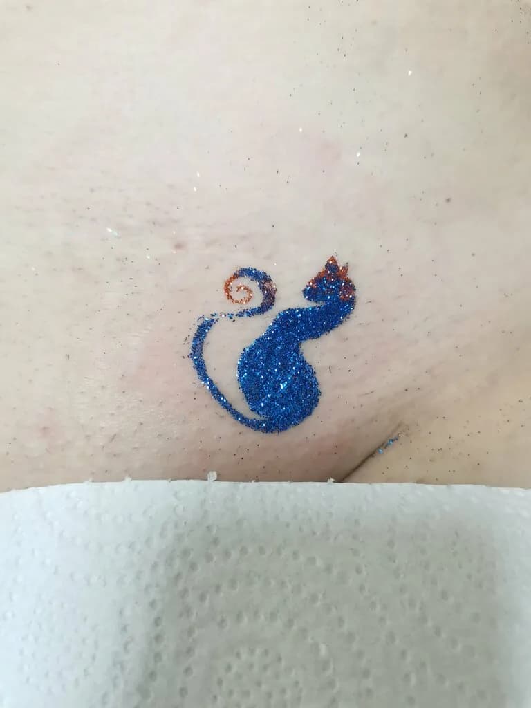 Петелька_эпил — фото 3
