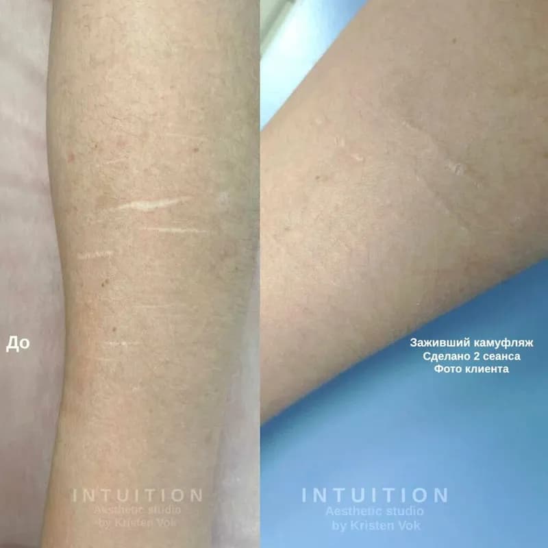 Intuition