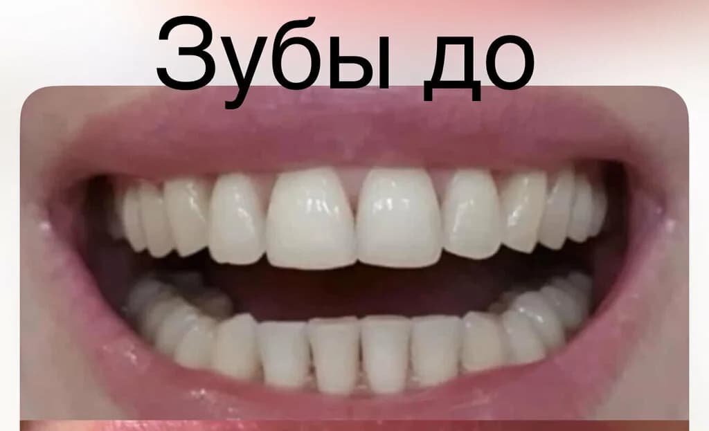 Стоматологический центр «VINIR (ВИНИР)» — фото 5