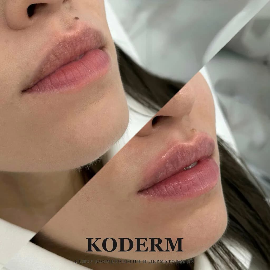 Центр косметологии и дерматологии KODERM (КОДЕРМ) — фото 4