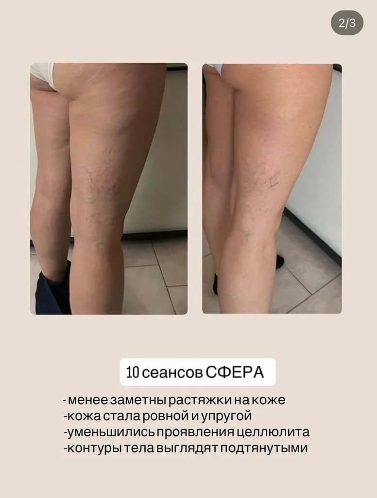 Красота есть здоровье — фото 4
