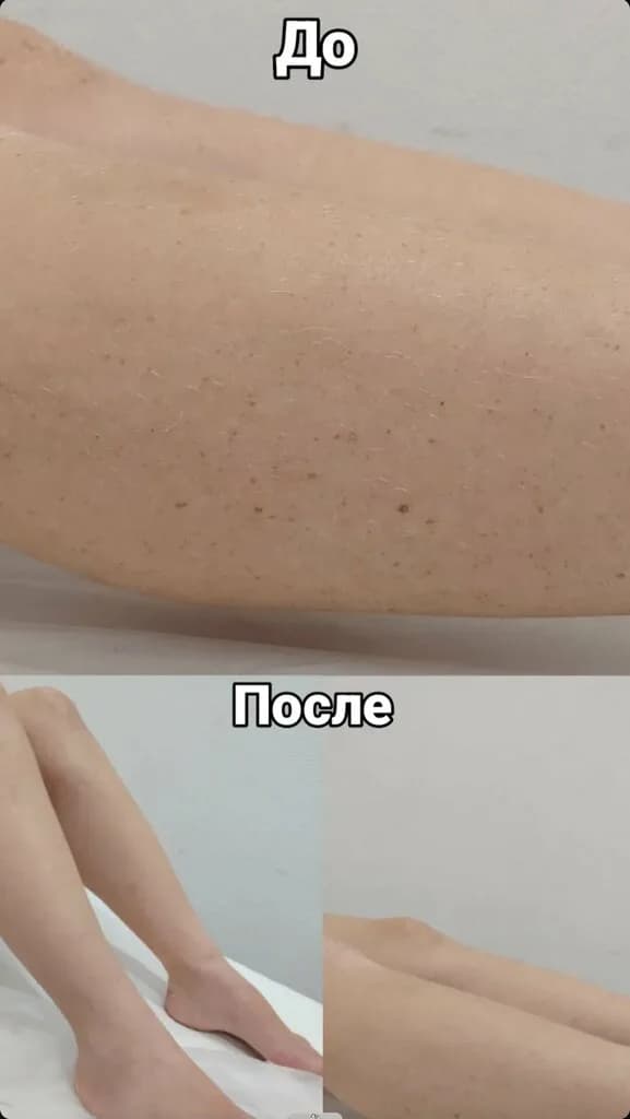 Ulichdepil