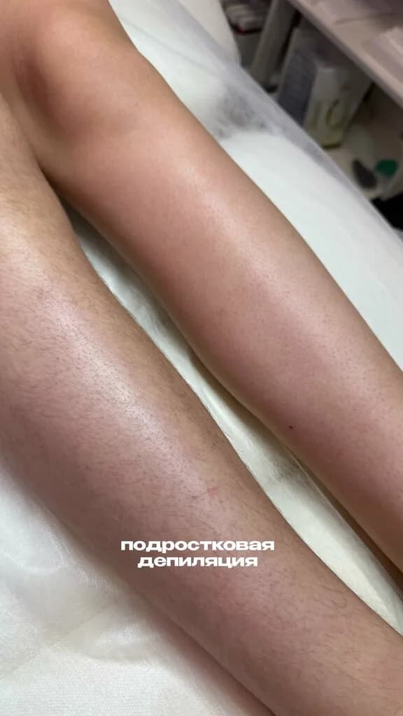 Студия депиляции